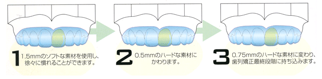 ステップ123