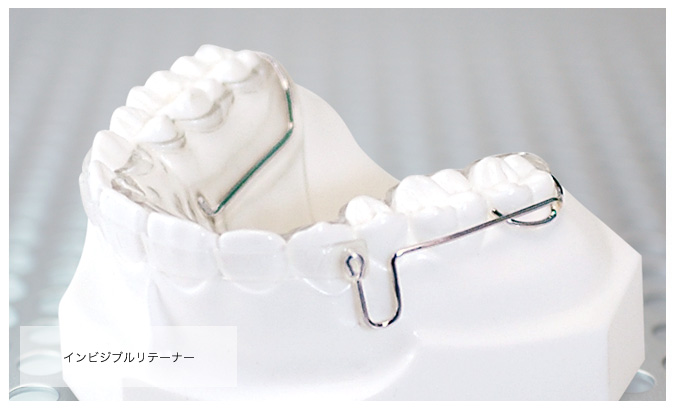 インビジブルリテーナー